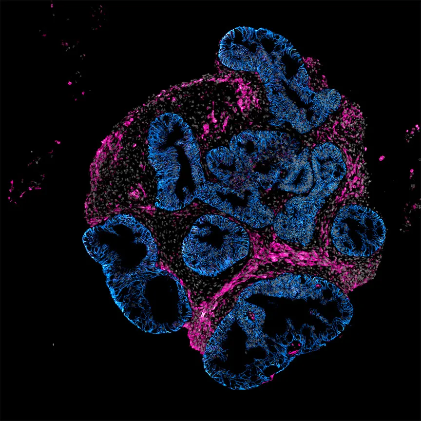 Intero Biosystems proposes human intestines for drug testing